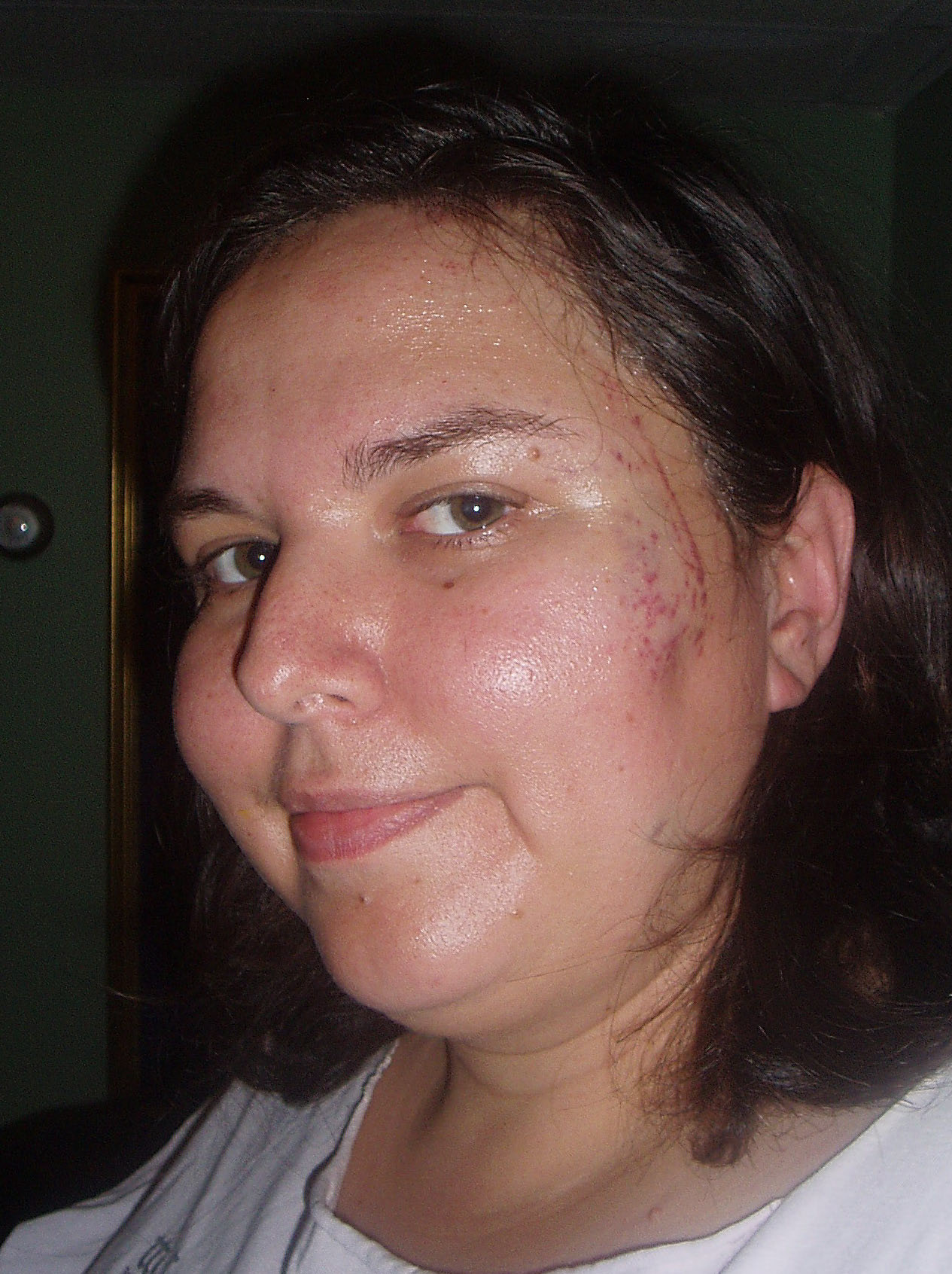 bikeaccident2006002_edited.JPG